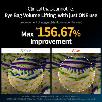 Dr Melaxin - Eyephalt Eyecream_Free Shipping